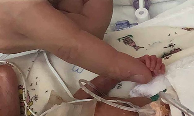 Orlando Health: Micropremie is Tiniest Baby to Ever Graduate from NICU